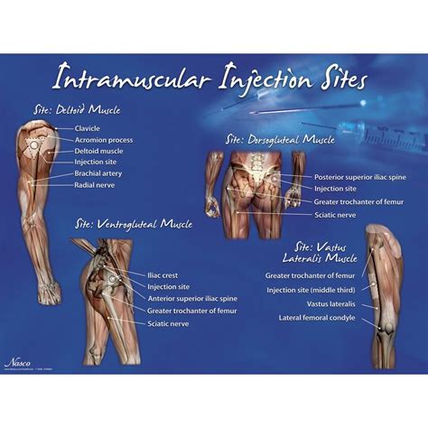 Intramuscular Injection 的图像结果