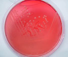鲍曼不动杆菌的生物膜高清图片下载-正版图片502722675-摄图网