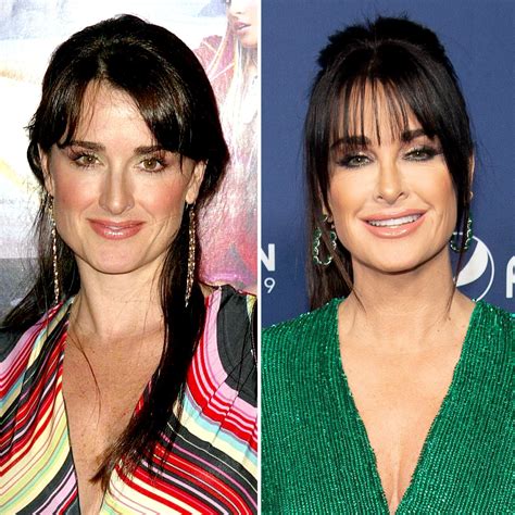 Top 10 kyle richards plastic surgery ideas and inspiration