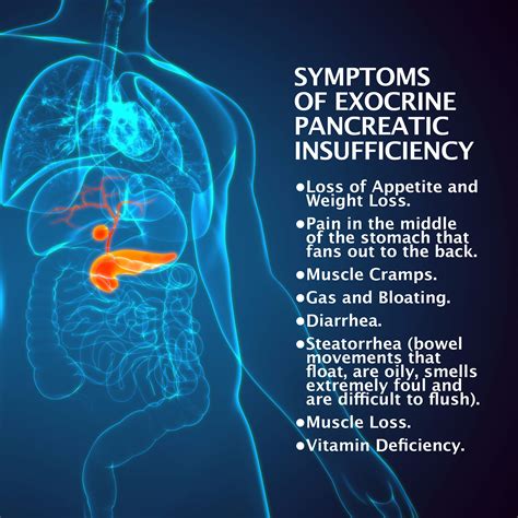 What Is Exocrine Pancreatic Insufficiency?