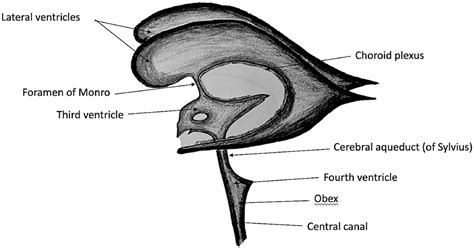 The different shapes of the fourth ventricle - Clinical Radiology
