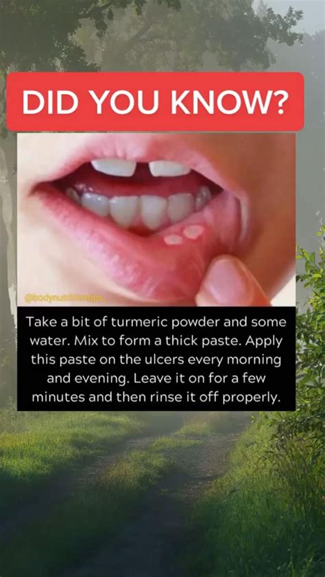Energy Drinks Cause Mouth Ulcers at Linda Redmon blog