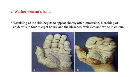 pathophysiology of drowning.pptx Dr. Haricharan MD RIMS Imphal . MBBS ...