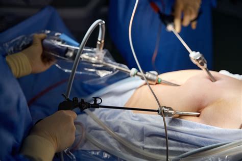 Kidney Removal Medical Term