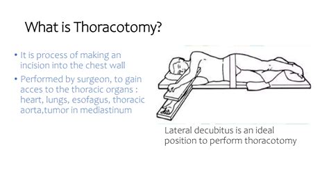 basic anatomi for toracic surgery 1.pptx