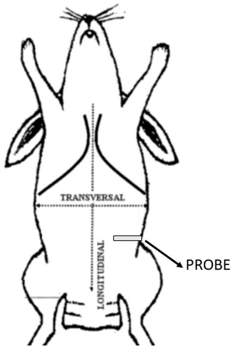 Ultrasound-Guided Lateral Transversus Abdominis Plane (TAP) Block in ...