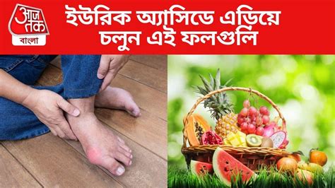 Uric Acid: এই ফলগুলি খেলেই হু হু করে বাড়বে ইউরিক অ্যাসিড - how to ...