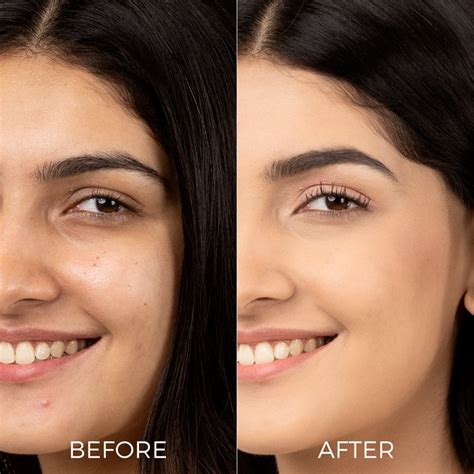 10% Vitamin C Face Serum For Glowing Skin | Reduces Pigmentation ...
