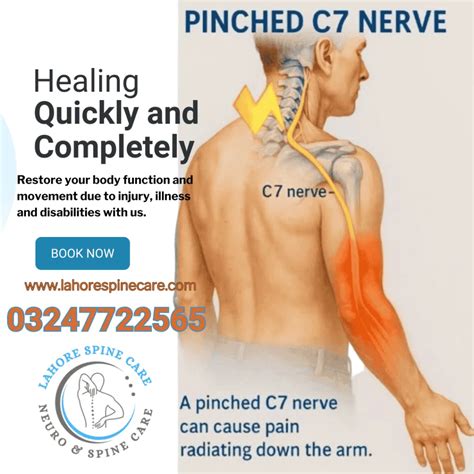 Cervical Radiculopathy: Pinched Nerve and How to Find Relief