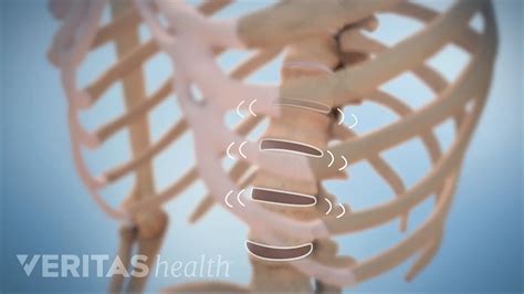 Image result for Back Cracking