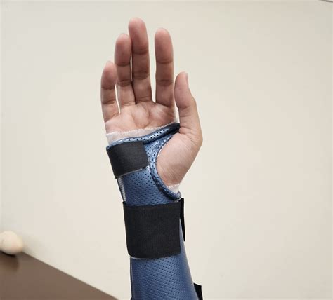 Sprained Wrist Treatment