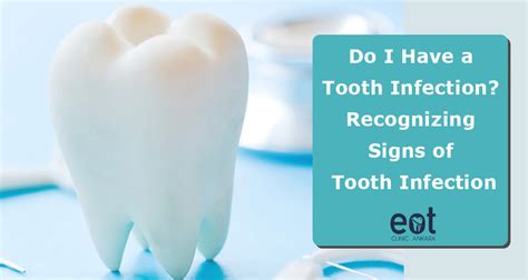 Do I Have a Tooth Infection? Recognizing Signs of Tooth Infection