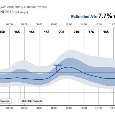 Image result for Pattern Management