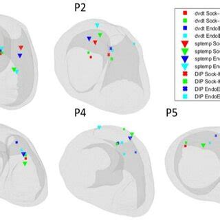 Image result for PVC Localization Chart