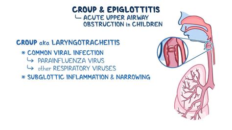 Croup and epiglottitis: Video & Meaning | Osmosis