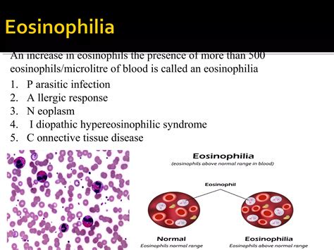 Eosinophils and Eosinophilia | PPT