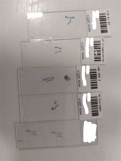 Image result for Poor IHC Staining