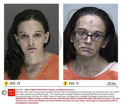 Before and after pics of crystal meth users are enough to put you off ...