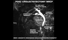 Image result for MRCP Views