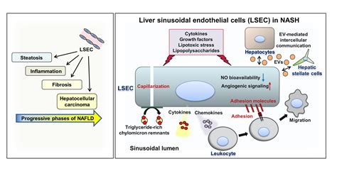 Emerging Roles of Liver Sinusoidal Endothelial Cells in Nonalcoholic ...