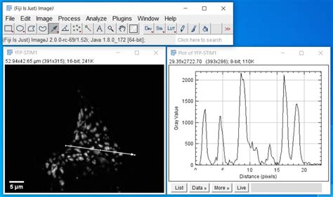 Fiji ImageJ Download 的图像结果