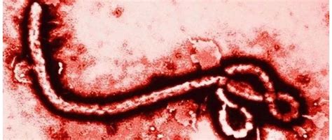 马尔堡病毒死亡病例现非洲，与埃博拉同族的病毒如此致命？ - 知乎