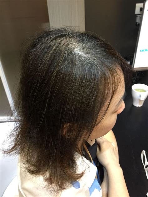 Dry Hair Loss | juliArt