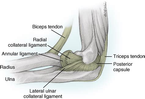 Fractures of the Radial Head - Clinical Tree