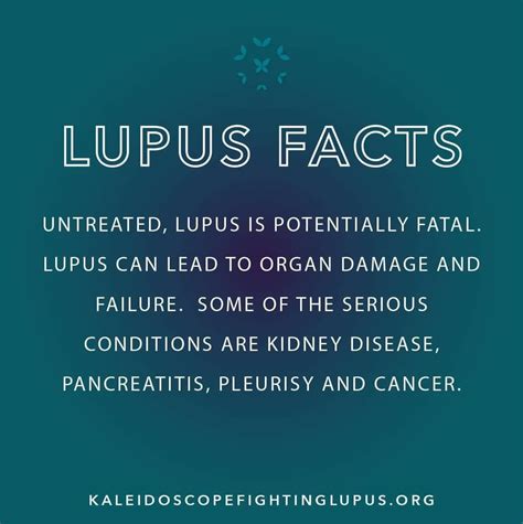 Lupus flares recognizing one triggers and prevention – Artofit