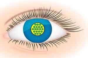 Ahmedabad: Municipal Corporation to inquire botched eye surgeries at LG ...
