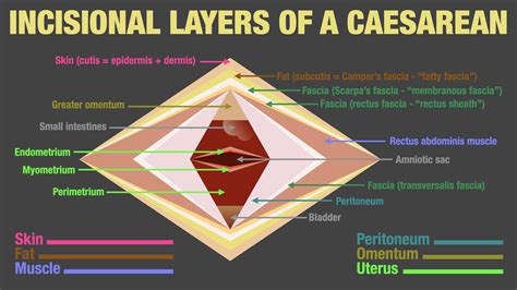 Layers Of Skin In C Section at Ava Ewers blog