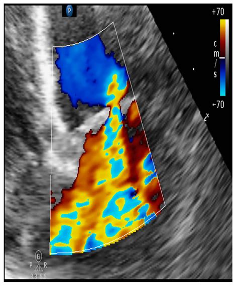 Translational Echocardiography: The Dog as a Clinical Research Model of ...