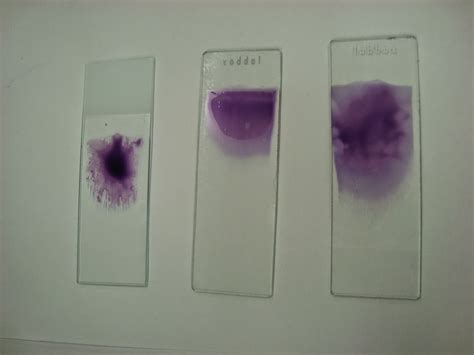 CUADERNO DE PRÁCTICAS HEMATOLOGÍA: Práctica: Detección de cuerpos de Heinz.