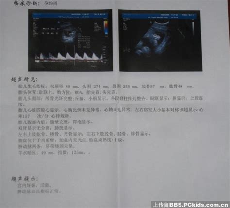 怀孕29周查出肝癌 女孩坚持生下宝宝-国际在线