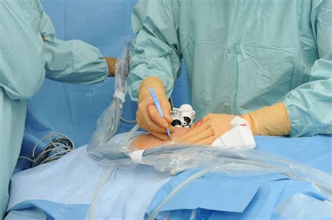 Actual Prostate Surgery 的图像结果