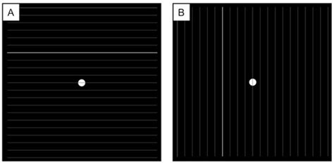 New Tablet-Based Written Examination System for Metamorphopsia ...