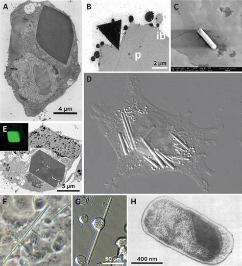 Image result for Protein Crystallization Image Magnification