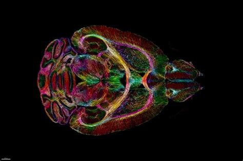 Image result for Prefrontal Cortex Mouse Brain