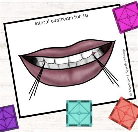 Rezultat imagine pentru Lateral Lisp Example