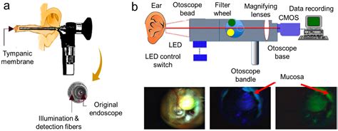 Inner Ear Infection Otoscope