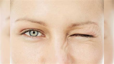 ಬ್ಲೆಫರೊಸ್ಪಾಸಮ್: ಕಣ್ಣುಗಳ ಈ ಸಮಸ್ಯೆಯನ್ನು ನಿರ್ಲಕ್ಷಿಸಬೇಡಿ..! | ಲೈಫ್ ಸ್ಟೈಲ್ ...