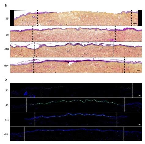 Burn Injury and Skin Explants | Encyclopedia MDPI