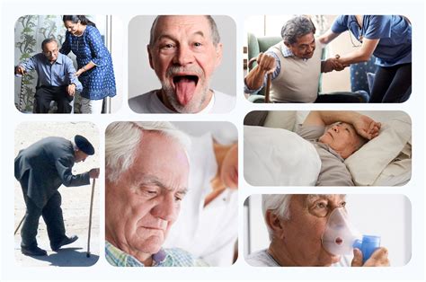 Ayurvedic Parkinson Treatment : SRIAAS