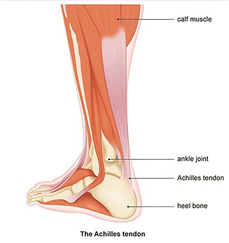 Achilles Tendonopathy, Tendonitis and Ankle Pain. – Eltham Foot Clinic