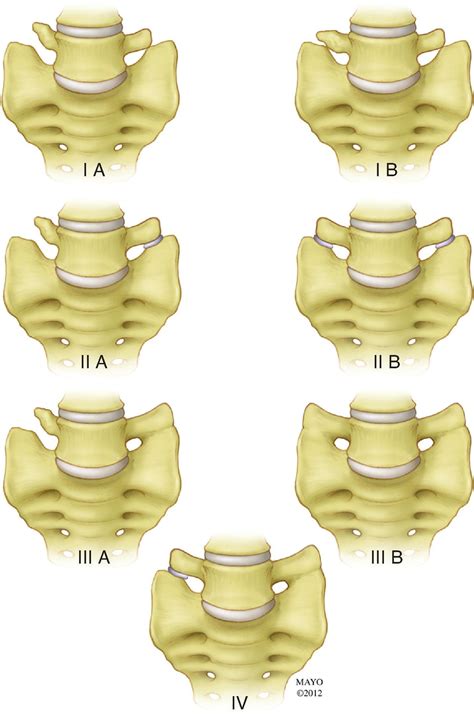 Radiologic Assessment of Patient With Spine Pain - Clinical Tree