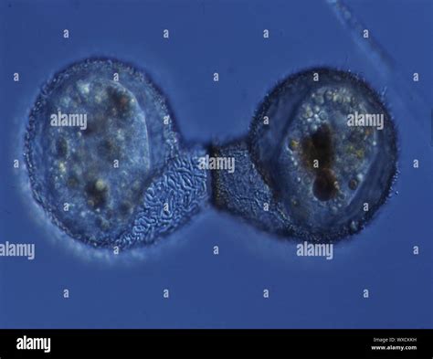 Image result for Amoeba Microscopy