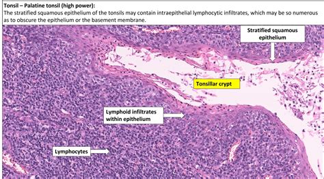 Tonsil – Normal Histology – NUS Pathweb :: NUS Pathweb