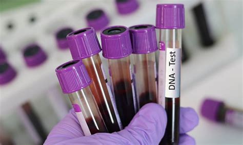 Courts Cannot Routinely Order Determination of Paternity By Way of DNA ...