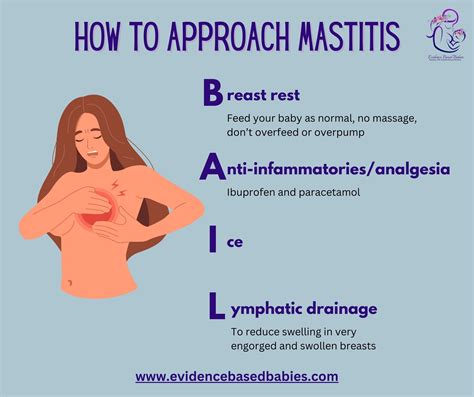 How To Prevent Mastitis