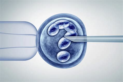 IVF Procedure Explained 的图像结果